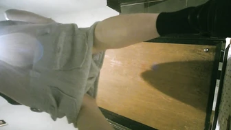 Exquisite Large Hemangioma 5V